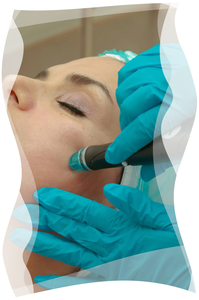 hydrofacial